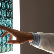 rak golovnogo mozga 0 - Онкологические услуги