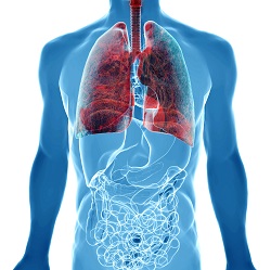 treatment of lung cancer in israel - Лечение рака лёгких в Израиле